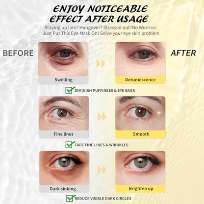 Maskiss Under Eye Patches (50 Pairs), Hyaluronic Acid Eye Masks for Dark Circles Puffy Eyes Undereye Bags, Collagen Eye Patches for Wrinkles and Hydrate, Skin Care Gift for Her