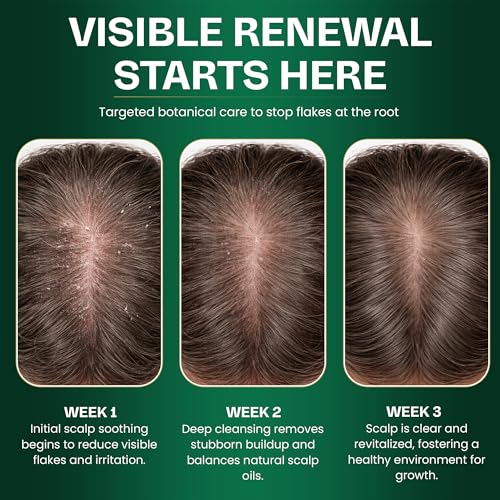 Tea Tree Shampoo & Conditioner Set | Thinning Hair Loss Treatments for Men and Women | Soothes Itchy Scalp & Dandruff | Boosts Hair Growth & Reduces Hair Loss | Sulfate & Paraben Free