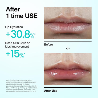 Anua PDRN Lip Serum, Long-lasting Hydration for Dry, Cracked Lips, Non-Sticky Moisturizing Lip Care with Salmon DNA, Hyaluronic Acid & Collagen, Korean Skincare, 0.33 fl.oz